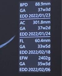 36w6dなのですが 大腿骨長と体重が少し予定よりも遅れていると思うの Yahoo 知恵袋