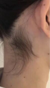 自分うなじの髪の毛が濃いんですが 脱毛サロンに行くと髪の毛は脱毛できな Yahoo 知恵袋