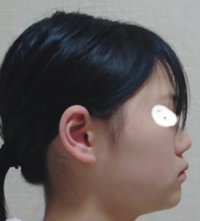 横顔ブスについてです 私は横顔ブスです 口が出ていて顎が後退しています で Yahoo 知恵袋