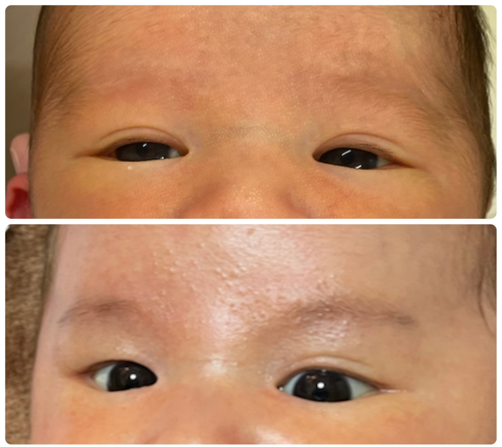 息子が産まれた時ぱっちりの二重でした 1ヶ月たたないくらいに Yahoo 知恵袋