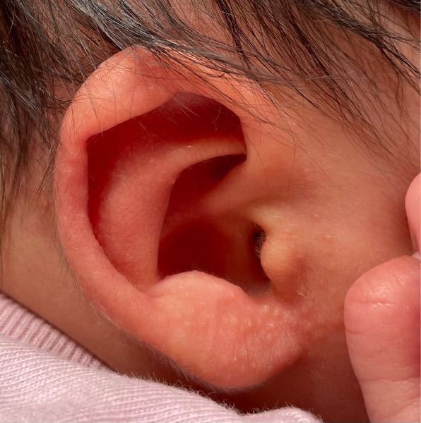 長男 2歳4ヶ月 の癇癪について 育児本によって書いてあることが Yahoo 知恵袋