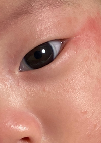 重い瞼 一重まぶたの赤ちゃんが二重になった方いらっしゃいますか Yahoo 知恵袋