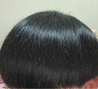 中二男子です このように切れ毛？が酷いのですがどのような方法が効果的に治せますか？