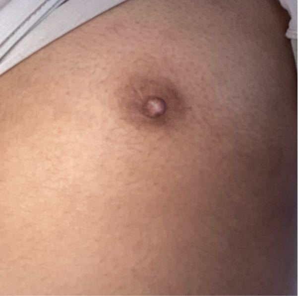 乾燥とストレスで全身が痒くなっていて胸が痒く掻いて居た時乳首 Yahoo 知恵袋