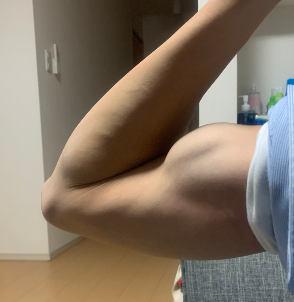 中学生です 腕の筋肉どうですか 部活で筋トレはしてます Yahoo 知恵袋