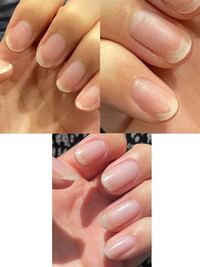 ハイポキニウムがすぐ剥がれる もともと爪のピンクの部分が Yahoo 知恵袋