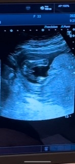 現在17週の妊娠5ヶ月で 今日検診にいってきました 性別は女の子希望な Yahoo 知恵袋