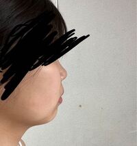 横顔が嫌いすぎます 鼻低すぎるし 頬の肉が多いし 顎も小 Yahoo 知恵袋