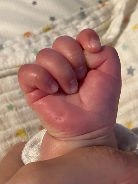 長男 2歳4ヶ月 の癇癪について 育児本によって書いてあることが Yahoo 知恵袋