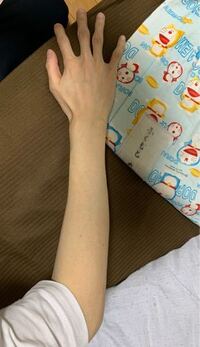 自分の腕なのですがこれ痩せすぎな気がするのですが気にしすぎで Yahoo 知恵袋