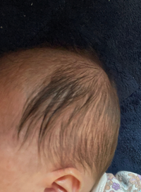 家の赤ちゃんの髪の毛は今 落ち武者状態です 男の子なんですが 髪の毛っていつ切 Yahoo 知恵袋