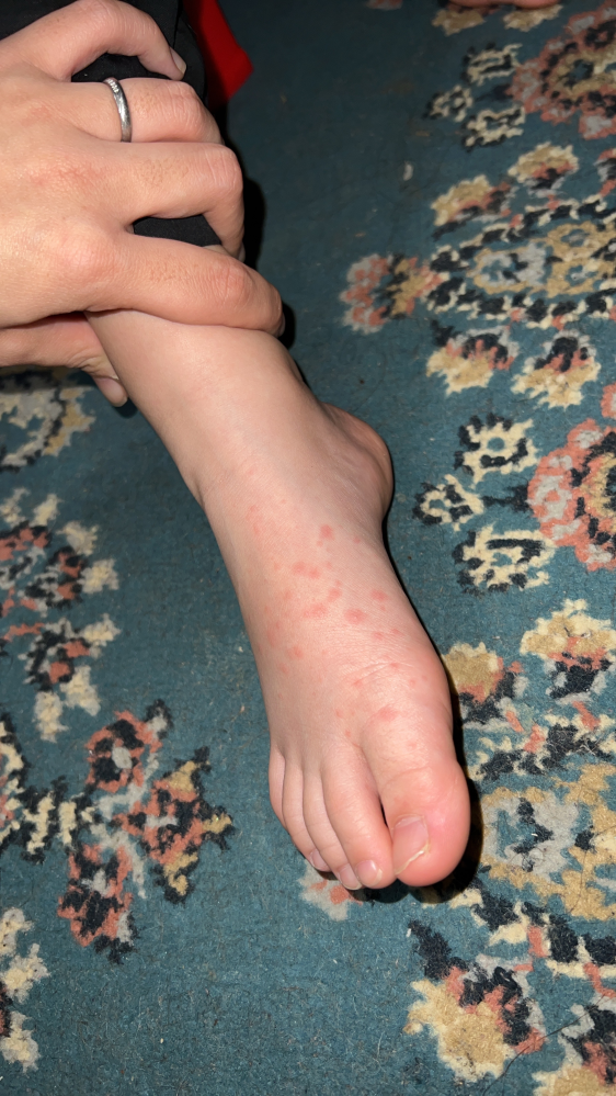 子どもの病気とトラブル 解決済みの質問 Yahoo 知恵袋