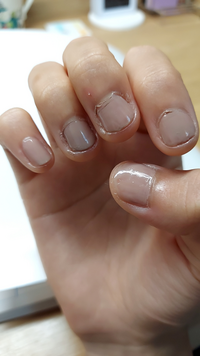 至急 初めてネイルしたんですけど 汚いですよね 見たら どう思います Yahoo 知恵袋