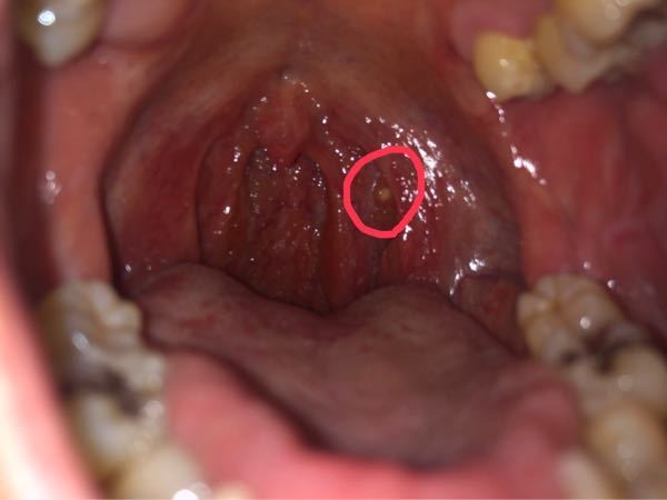 喉に入れてしまったのですが、どうやって見分ければよいのでしょうか？