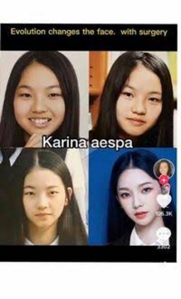 aespaのカリナの整形前のこの写真って本当に本人なのですか？？整形でこんな変われますか？どこをどう整形したらこの写真から今のカリナくらいまで美しくなれるのか教えて頂きたいです 