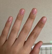 この爪は深爪ですか 気持ち悪いですか Yahoo 知恵袋