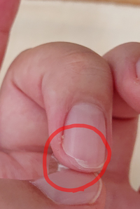 包丁で切って爪が変な風に切れてしまいました 閲覧ありがとうございます Yahoo 知恵袋