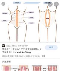 悲報 帝王切開した後は お腹こうなってるからどんなに腹筋して Yahoo 知恵袋