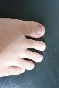 足の爪ですいません 親指の爪長いでしょうか 短くすると Yahoo 知恵袋