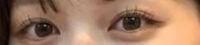 この目は手を加えていない天然の二重瞼に見えますか？ 