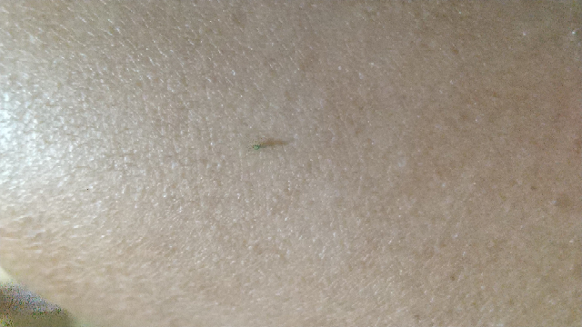 この虫なんですか？ １ミリくらいです。夜になると出てきます。 画像悪くてすみません。小さすぎて限界です。
