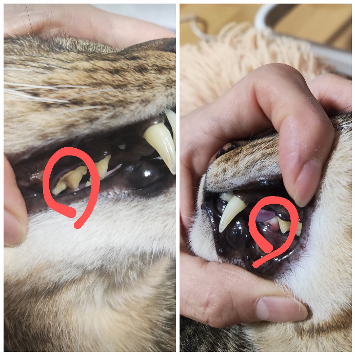 9歳の猫です。 歯磨きはしてますが、歯石がついてしまいました（写真左）。 歯肉炎も1か所あります（写真右）。 他の歯は特に問題ないのですが、もっと高齢になってからの歯石取りを考えたら、今のうちに歯石取りした方が良いのか迷ってます。 9歳でも全身麻酔する事がとても怖いのですが、年齢上がればもっと怖いです。 歯周病になると猫は命に関わる程酷くなるみたいですし、内臓まで悪くなり病気になったり、痛みからご飯食べれなくて死んでしまったりするみたいですね…。 今は軽度だと思うので、歯石取りするべきか悩みます。でも、まだこの先何年も生きるだろうし、先の事を考えたら今以上高齢になる前に歯石取っておくべきかずっと悩んでます。 皆様どう思いますか？また、9歳での全身麻酔が不安です。大丈夫でしょうか…腎臓を悪くしたりなどありますか？