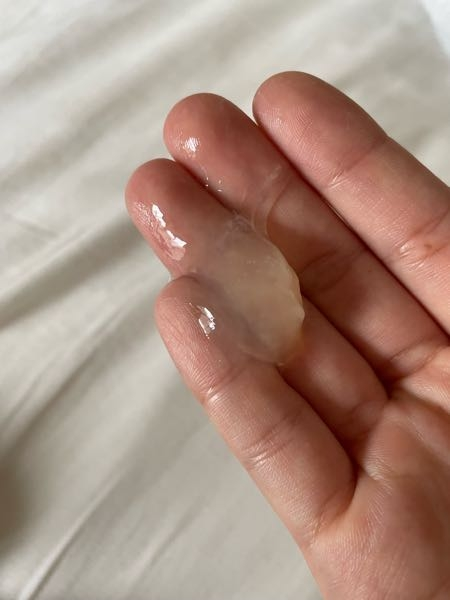 閲覧注意最近この卵白みたいなのが出る量が増えてる気がします そもそもこ Yahoo 知恵袋