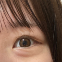 涙袋を作るマッサージで実際に0からできました って言うものがあったら教えてく Yahoo 知恵袋