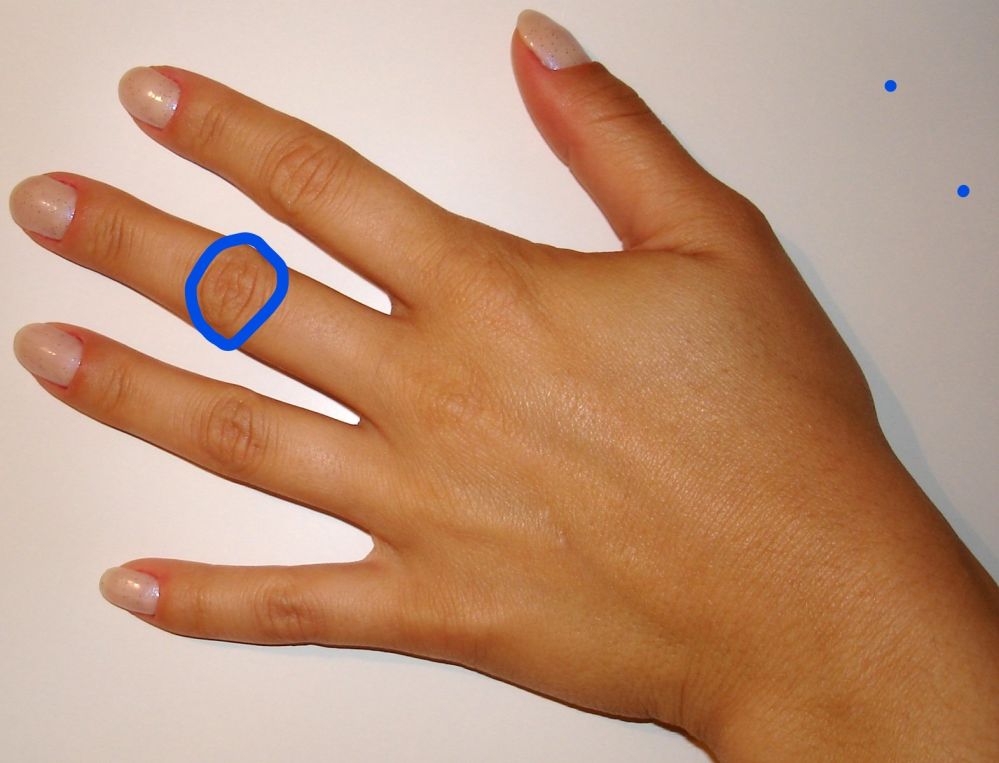指の関節のしわの部分は何という名前ですか。 画像の青丸の部分です。
