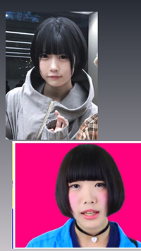 あのちゃんについてです 背景がピンクの方の整形してない時の画 Yahoo 知恵袋