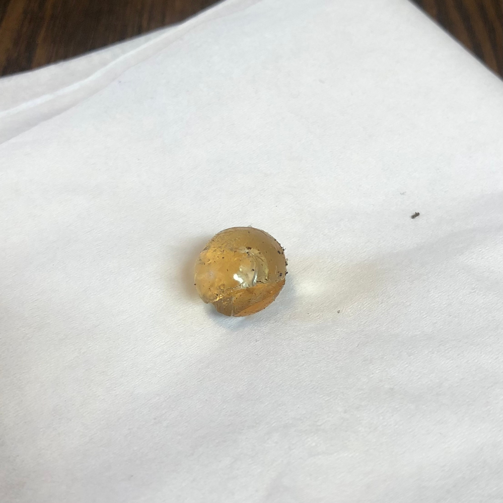 ベランダに丸くて黄色いゼリー状の物体が落ちてたんですけど、なんかの虫の卵だったりしますか？1cmぐらいの大きさです 消臭剤かなとは思ったのですがベランダに落ちてるはずがないので考えにくいです