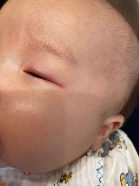 2ヶ月の赤ちゃんなんですが たまに目の周りが赤くなります。 アレルギーですかね？ 病院行くなら 小児科？皮膚科？眼科？