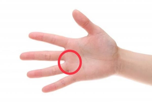プロセカを親指でやっている者です。 スマホを持つとき中指と薬指の間ぐらい支えているのですが最近画像の赤丸のところが痛くなってきました。 どうすれば良いですか？