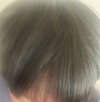 毛量が多く髪も太め です 髪型もあると思うんですけど垢抜けないです 美 Yahoo 知恵袋