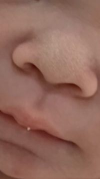 新生児の男の子です 生まれたばっかの鼻なのですが 鼻の穴が大きい感じが Yahoo 知恵袋