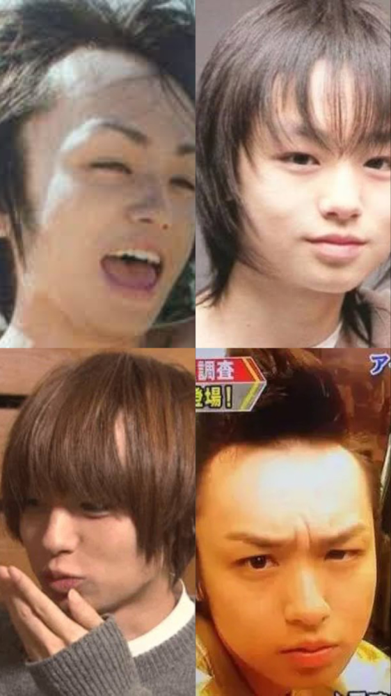 伊野尾慧おでこ