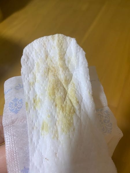 おりものについてです 現在 生理前で黄色いおりものがでています 匂いや Yahoo 知恵袋