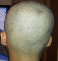 この顔で五厘刈りって似合うでしょうか 五厘にしても似合うと思 Yahoo 知恵袋