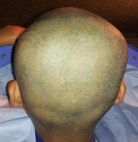 夏休みの宿題を忘れてしまったので お父さんに怒られ五厘刈りにされました Yahoo 知恵袋