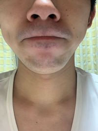 歳で昨日剃ってこのヒゲは濃いですか はい Yahoo 知恵袋