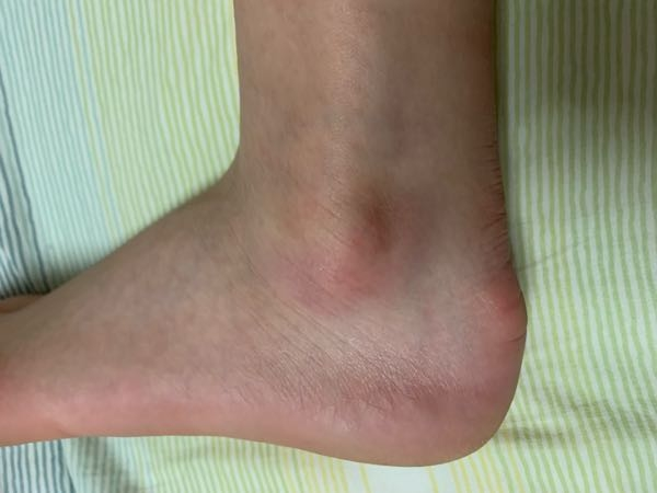 バスケットボールをしています 私は足首の捻挫が癖になっていて 練習中も Yahoo 知恵袋