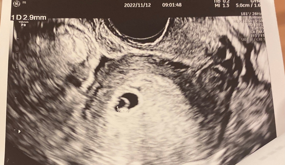 妊娠 出産 投票受付中の質問 Yahoo 知恵袋