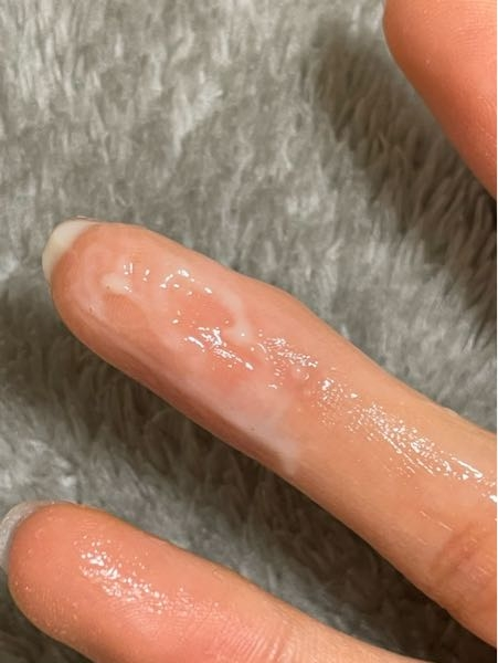 女性の病気 投票受付中の質問 Yahoo 知恵袋