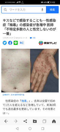 画像