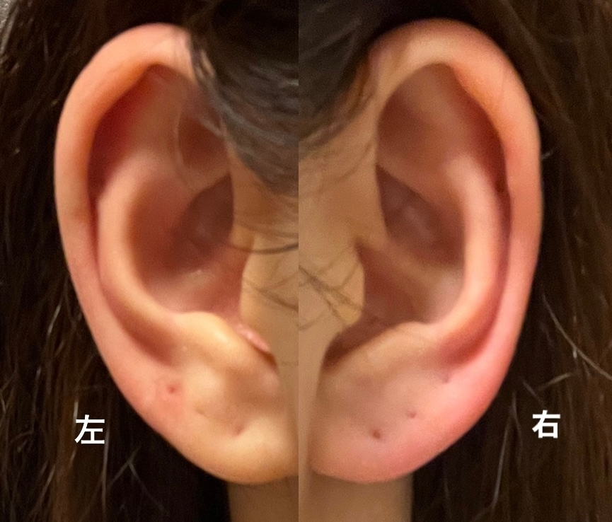 a 左5、右4 合計9枚 ピアスの位置についてです。現在、左5箇所右に4箇所開けていま