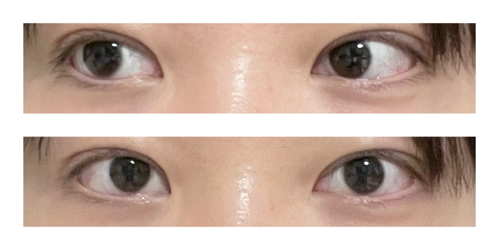 黒目小さい見て！！面接官居ますか？カラコンについて！ 黒目が小... - 教えて！しごとの先生｜Yahoo!しごとカタログ