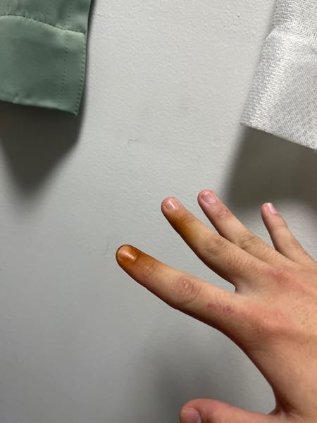 私は喫煙者なのですが、指がヤニのせい？でキモイ色になっているのですがどうすれば治りますか？