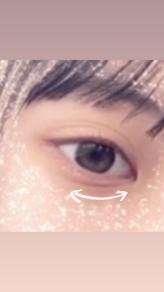 画像のように私は生まれつき、目の下(涙袋？？)に線があります。ゴルゴ線でしょうか？？ これがずっとコンプレックスで、メイクで涙袋を描きたくてもこれが邪魔で書けません。 線の原因、対処法、ゴルゴ線...