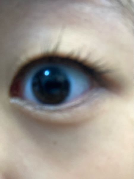 これ、二重になりそうですか？？ 私はど一重です。前までアイプチつけてる時だけ二重になればいいやと思っていましたが、姉が埋没をしてすごく楽そうだったので癖づけたいと思うようになり、眉毛を揉んでみたり、癖づけ用のテープを貼ったりしてみて、取ってから3時間くらいは黒目の半分くらいまで線が見えるかな、?みたいな感じになりました。写真は普段の目です。続けたら二重になりますかね？ 親は奥2重で高校生の頃に自然と線が着いたみたいです。