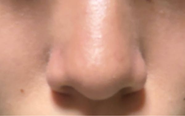 至急 鼻がすごくコンプレックスで、ノーズシャドウも上手くいきません。どのようにノーズシャドウを入れたら良いでしょうか‪( т т )‬